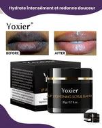 Load image into Gallery viewer, Yoxier™ | Brightening serum for dark or tobacco-damaged lips (Satisfaction guaranteed or your money back)
