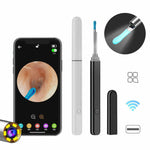 Load image into Gallery viewer, Visual Earwax Removal Tool – 360° HD Camera
